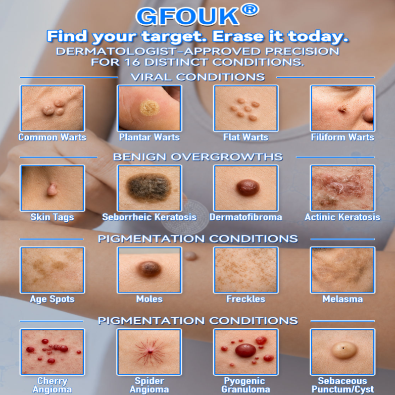 ✅✅ 𝐎𝐟𝐟𝐢𝐜𝐢𝐚𝐥 𝐒𝐭𝐨𝐫𝐞 | GFOUK®  ☘️𝐁𝐨𝐭𝐚𝐧𝐢𝐜𝐚𝐥 𝐌𝐢𝐜𝐫𝐨𝐧𝐞𝐞𝐝𝐥𝐞 𝐇𝐲𝐝𝐫𝐨𝐜𝐨𝐥𝐥𝐨𝐢𝐝 𝐏𝐚𝐭𝐜𝐡 (𝐅𝐨𝐫 𝐒𝐤𝐢𝐧 𝐓𝐚𝐠𝐬, 𝐒𝐦𝐚𝐥𝐥 𝐒𝐤𝐢𝐧 𝐆𝐫𝐨𝐰𝐭𝐡𝐬, 𝐖𝐚𝐫𝐭𝐬, 𝐌𝐨𝐥𝐞𝐬, 𝐀𝐠𝐞 𝐒𝐩𝐨𝐭𝐬 & 𝐏𝐢𝐠𝐦𝐞𝐧𝐭𝐚𝐭𝐢𝐨𝐧 𝐂𝐨𝐧𝐜𝐞𝐫𝐧𝐬)